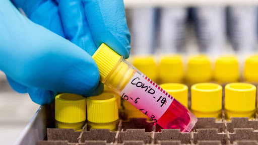With 30 new cases Cuba accumulates 350 Covid-19 patients